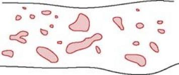 ./home/Physique/Microscopie-3D/figure12.jpg